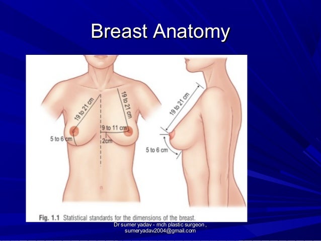 pattern breast reduction Darla teen model